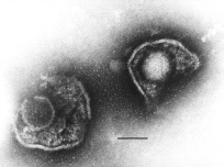 herpes 1