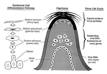 papillo wart